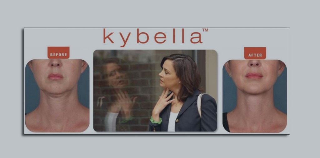 psi blog kybella double chin featured